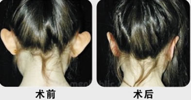 ���L(f��ng)���C���g(sh��)�Л]�и�����