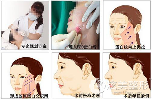 �沿������Ч���Æ��ܾS�ֶ��