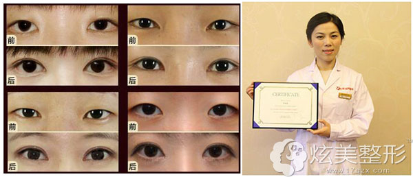 ����ľ�R�A���������Gϼ�t(y��)�����L�p��Ƥ������չʾ