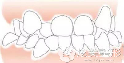 �Ĵ����c(di��n)���������t(y��)���v�⣺���X��D��(y��n)�����C����Ҫ������?