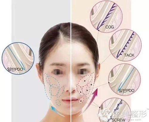 �R��ɽ���AԬ����t(y��)��������������������F(xi��n)�沿��Ӳ��