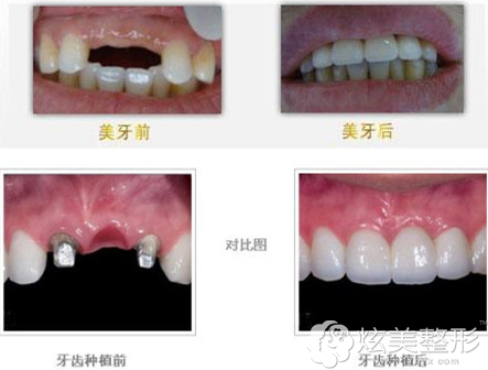 ��ǻ���M(f��i)�߆�?����8063Ԫһ�w�Nֲ��Ч���ò�