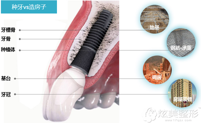 �Nֲ�������w���ӡ�һ��