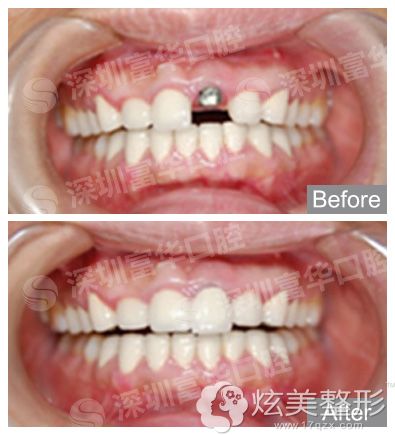 ���ڸ��A���w���Nֲ����