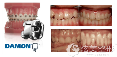 ���X���R���_����ô�C��?�����X�C���r(ji��)���F���F