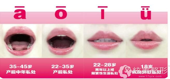 ����Ů��˽�������ļҺ�?��(l��i)��318�����_(k��i)�I(y��)���o�ۻ���D��