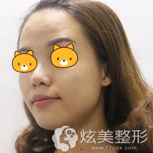 �����ں������n��Ƥ�뼤����ߺ���ξܽ^�f���ߡ�����