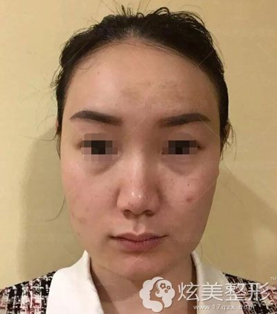 ���@���ĵĽB�d�S���沿�����g(sh��)׌�Ҹ�e������Ů�˵ı���