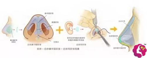 �L(zh��ng)ɳ���R4Dȫ�����ܿ��ޏ�(f��)�����ӌ��ǿ��ⷭ�ı�ʧ�����