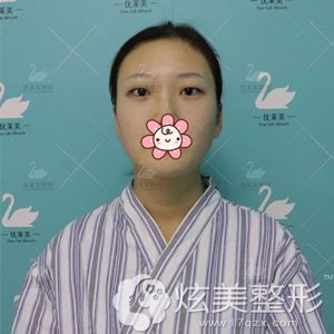 �Թ�Ů��׃��ͨ��������ȫ���p��Ƥ�۾C���_(k��i)ʼ