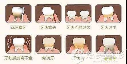 ��������ʿ���ս�����X�N���Ƿ���Ҫĥ��?�r���F��