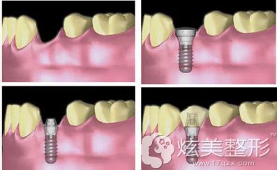 ����������ǻ�t(y��)Ժ��΢��(chu��ng)�Nֲ���^��