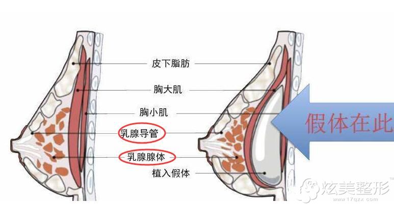 ������11��ǰ����¡�����ι��ή�s��ȡ�����·ż��w��