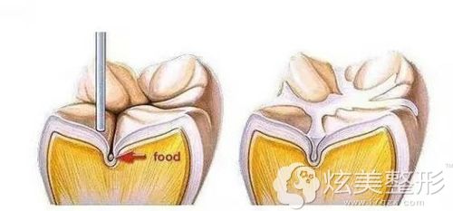 �C�Ϸ��]�����g(sh��)���E��(ji��n)�׈D