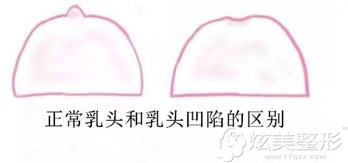 ���^��(n��i)�ݠ��������E�D��������Lԇ���^�������g(sh��)�ö����X