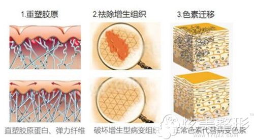 co2�cꇼ����ޏͰ��ݰ̺�Ч��