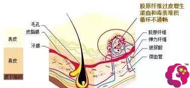 �����γC���g��������F(xi��n)�̺�����ԓ���ȥ��