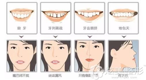 �W(w��ng)���f�����Ժ�ǧ�f�e�������놖��35�q�˹�������������