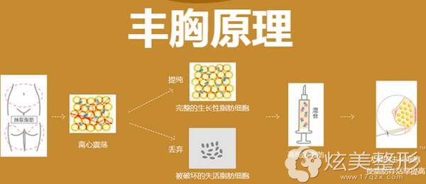 ���w֬���S��һ��(c��)ע��150�������ن�?300cc�ܴ�ׂ���