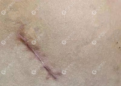 ������������������ʮ��������g�̺��ö�����̼������ȥ���