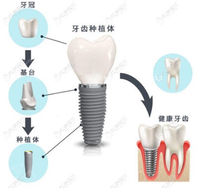 �Nֲ������ʿITI�͵�BEGO�ą^(q��)�e���H�ǃr(ji��)����߀��......