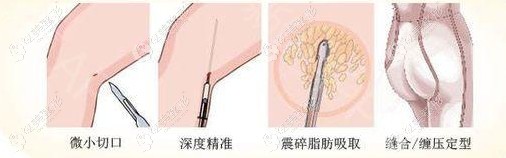 �����ȭh(hu��n)����s���l֪����֬һ�εö��X