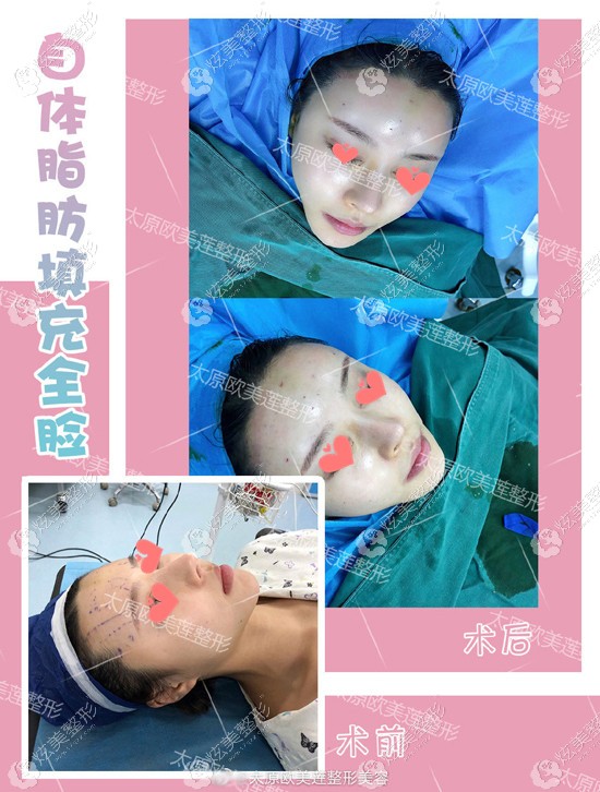 ���M(j��n)����̫ԭ�W��ɏ���S�x֬�����ȫĘ���M(f��i)�ø߆�