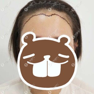 �Nֲ���˼���Ҫ����ë��?�ҷN500��λ���h(yu��n)�x�˸߰l(f��)�H��