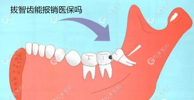 �V������ǻ��ˢ�t(y��)������?Ҫ�ǰ����X800Ԫ�܈�(b��o)�N����