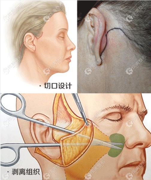 �沿С��Ƥ���g(sh��)�пڵ�λ�úʹ�С�ǲ��ǌ�(du��)�̺���Ӱ���