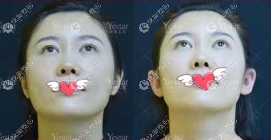 ����ˇ��ע�侫�`��Ч���D���ȣ���10֧Ī����ɯ�����ж��N���