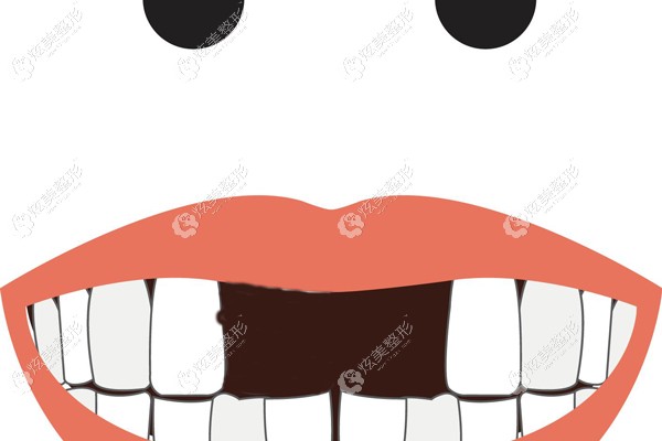 �T��ȱʧ2�w�ÿ�������߀��ȫ������?�r(ji��)���υ^(q��)�e��