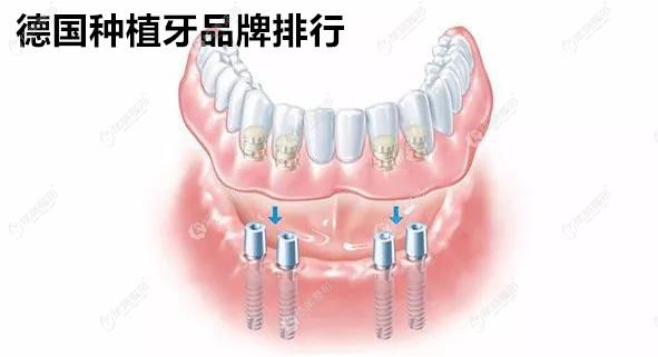 ���Nֲ��Ʒ����������bego/icx����(g��)�Nֲ�w�ăr(ji��)����Կ�