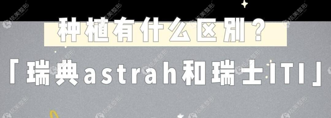 ��ʿiti�Nֲ��һ��r(ji��)������Xһ�w?��(du��)�����astra�Nֲ�w�Ă�(g��)��